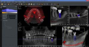 رادیوگرافی OPG پانورامیک Owandy اواندی CBCT و سفالو مدل imax touch 3D