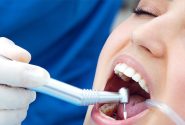 روش های نگهداری از توربین دندانپزشکی