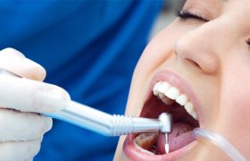 روش های نگهداری از توربین دندانپزشکی