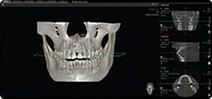 رادیوگرافی OPG پانورامیک vatech واتک CBCT و سفالو مدل PaX Duo3D