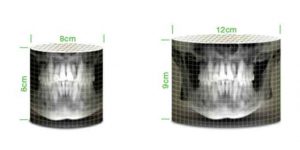 رادیوگرافی OPG پانورامیک vatech واتک CBCT و سفالو مدل PaX i3D Green