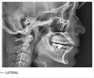 رادیوگرافی OPG پانورامیک vatech واتک CBCT و سفالو مدل PaX i3D Green