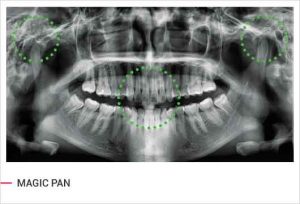 رادیوگرافی OPG پانورامیک vatech واتک CBCT و سفالو مدل PaX i3D Green