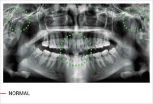 رادیوگرافی OPG پانورامیک vatech واتک CBCT و سفالو مدل PaX i3D Green