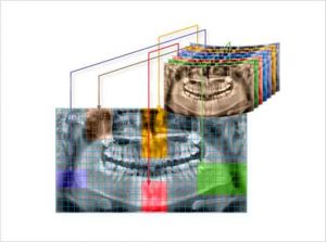 رادیوگرافی OPG پانورامیک vatech واتک CBCT و سفالو مدل PaX i3D Green